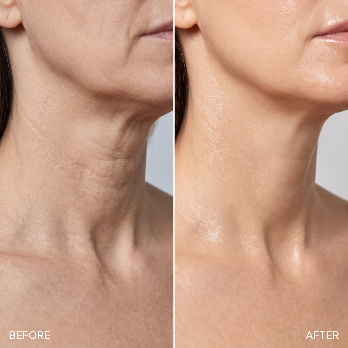 The Platysma Serum - PDRN + Copper Peptide Neck & Décolletage Treatment
