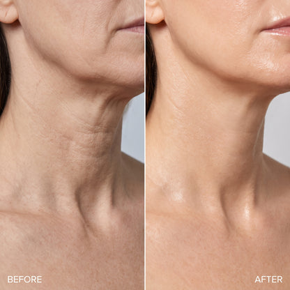 The Platysma Serum - PDRN + Copper Peptide Neck & Décolletage Treatment